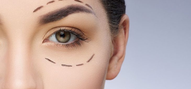Existe Idade Certa Para Fazer A Blefaroplastia Tatiana Nahas